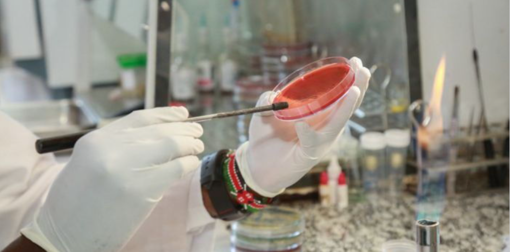 JOOTRH Study Finds 60% of Kisumu Market Fish Contaminated With E. Coli